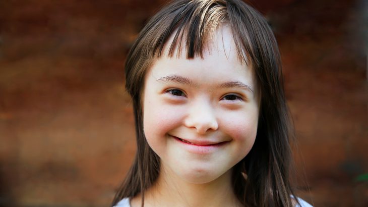 Παγκόσμια Ημέρα για το Σύνδρομο Down: Κάποια χαμόγελα είναι απλά ανεκτίμητα