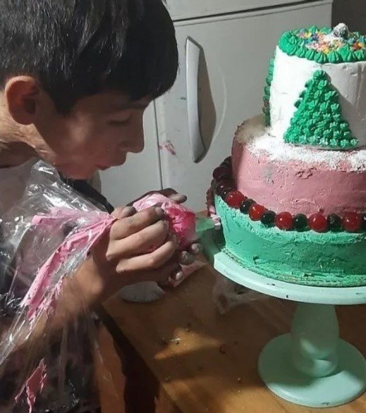 Joaquin: Η ιστορία του 10χρονου με σοβαρά εγκαύματα ο οποίος πληρώνει μόνος του, τις επεμβάσεις του φτιάχνοντας τούρτες